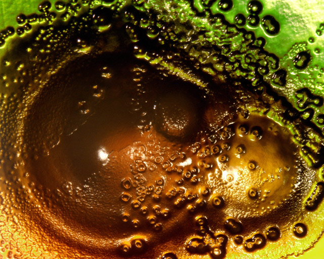 Entry_24604_Entry_21667_Entry_19975_bacteria-seperate-forms-and-nodules--mag-20x--3-17-06